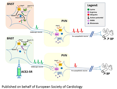 ESC_Journals's tweet photo. Short-circuiting #BloodPressure regulation🔌⚡️

#ANGII upregulation of neural Nedd4-2 promotes #ACE2 ubiquitination to decrease PVN sympathetic inhibition &amp; drive #hypertension
https://t.co/sYErpFMeJm

@CVR_TomaszGuzik @DrMikeDrozd @glenpyle #CardiovascularResearch #CardioTwitter https://t.co/I9O0s9dMFS