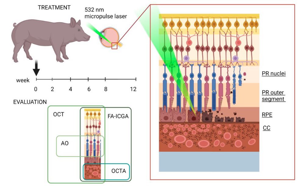 laser-induced porcine model of outer retinal & choroidal degeneration for preclinical testing 

This model is optimal for testing cell & GeneTherapies for outer retinal diseases including #Choroideremia.
@Kapilbharti123 Dr.David Gamm @UWMadison