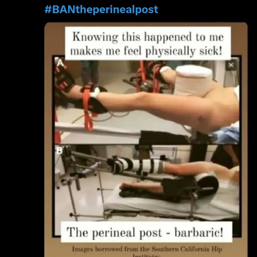 @hanna_pssd No patient should end up with a completely new, more traumatic injury from a non-urgent operation. 

I would NEVER have risked my sexual function had I been given the choice but I wasn't.

I am still horrified this was done to me WITHOUT my consent.

@LonOrthopaedic
@PGhospital