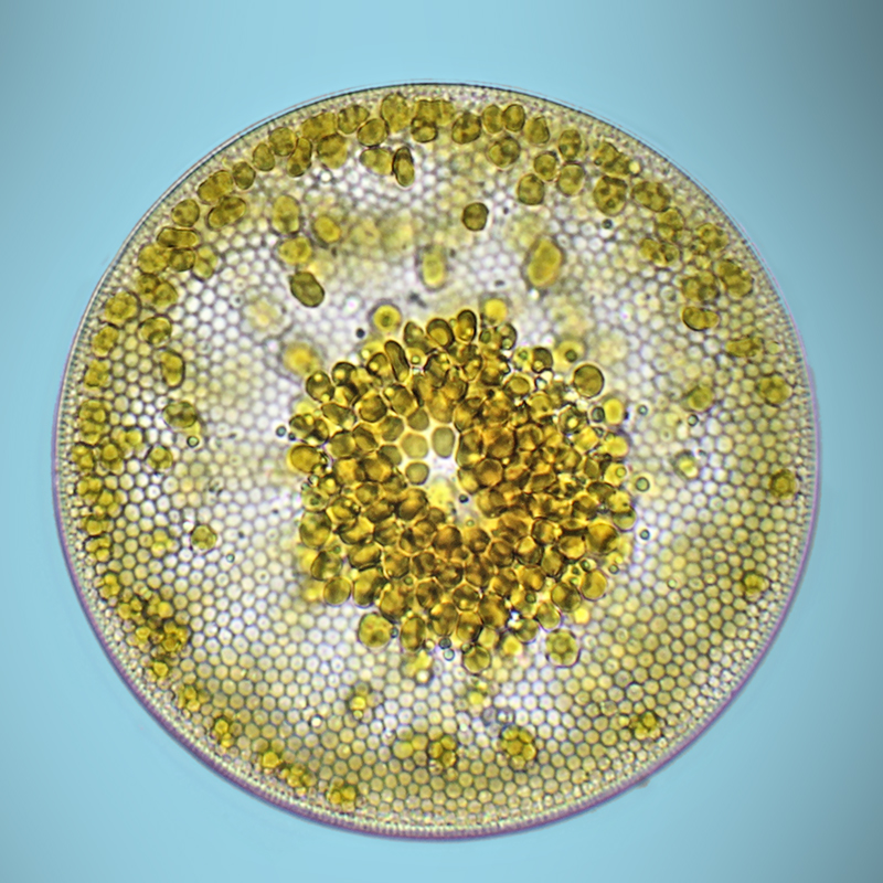 MoticEurope's tweet photo. This year we are joining the #WorldOceansDay to support the preservation of the ocean and spread awareness of its importance, and we do it by sharing with you some marine diatoms. #Diatoms are good indicators of our environmental change.
#OceanFirst
📷 © https://t.co/Gtpr9FmyuN https://t.co/6ejfrH9lBx