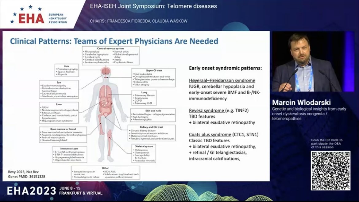 emmamgroarke's tweet photo. Another great talk #telomere biology disorder from @marrowgenes @StJude looking from a genetic / pediatric POV. Multi-organ disease = many specialists needed. Ongoing discoveries of new genetic causes; interesting role of somatic rescue. @TeamTelomereInc @EHA_Hematology #EHA2023 https://t.co/D047xSbCiQ