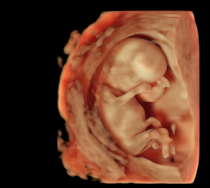 Thomas_SF44's tweet photo. Avez-vous déjà vu ...

... un embryon humain âgé de 10 semaines ? 

Maintenant, oui ! 

#Echographie #3D #T1 https://t.co/odrQqhQwCg