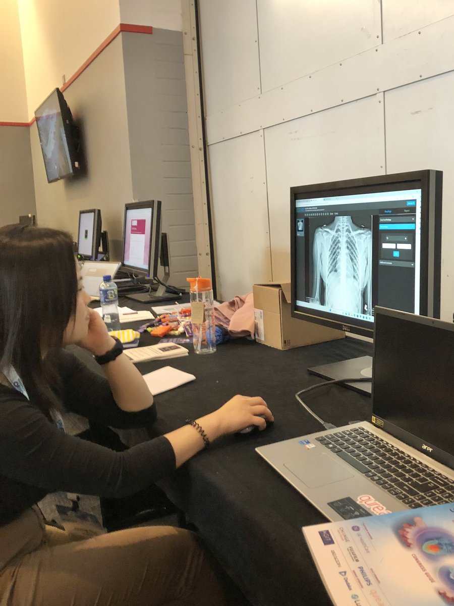 ShPingu's tweet photo. Lots of lovely data collected in the Research Hub at #ukio @UKIOCongress @xray_nick @sarim_ather @ClareRaineyUU @sonyia_mc @AndyCreeden @qure_ai https://t.co/Y7zl0bgDFt