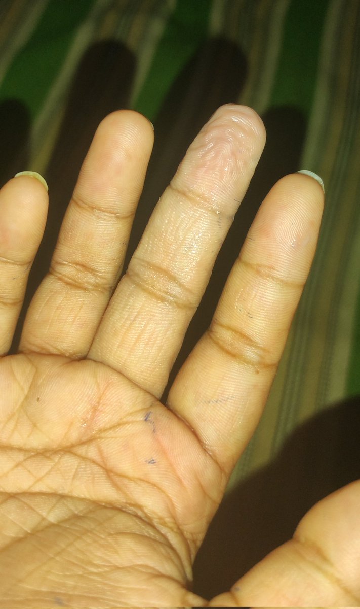 pipo_talks's tweet photo. You know it was a good session when middle finger looks like that 💕 #fingering #TakeTwo https://t.co/lv5d4xEOLt