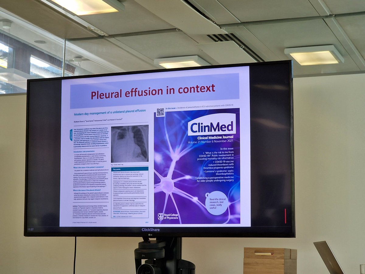 RespiratoryACPs's tweet photo. A fantastic session on the diagnosis &amp; mgt of pneumothorax &amp; pleural effusion from Dr Panchal from UHL. 

Top tips:
⭐️Don't rush to put in a chest drain in a unilateral effusion. 

⭐️Only put in a chest drain once you know the cause of the effusion.

@leicschestdoc #RACPN23 https://t.co/uPYUYOQKAn