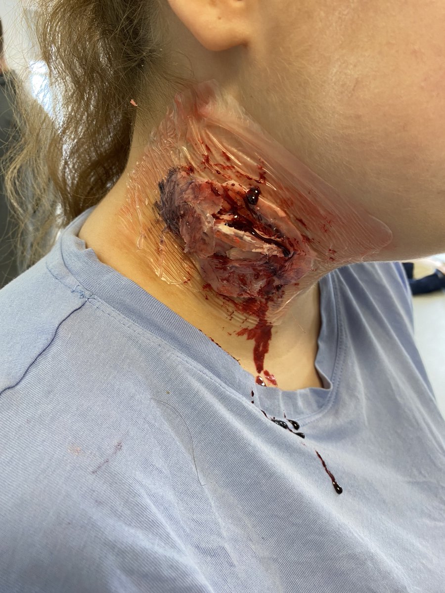 UHSimulation's tweet photo. A little bit of moulage practise, varying degrees of success - but we are getting there... @UHParamedic  @UH_HSK #moulage #simulation https://t.co/rI0bF4S1qX