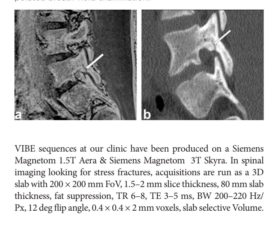 ɹǝʇlnoԀ pıʌɐᗡ 🚴🏻 🇺🇸 🇦🇺 🇬🇧 on Twitter "VIBE MRI an alternative to ct in the imaging of sports
