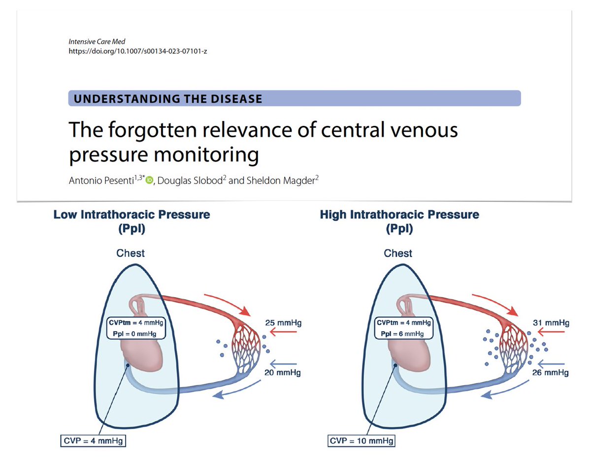 The forgotten relevance of CVP (& its change over time) monitoring in #ICU
🫀 measurement & normal values
🫀 impact of high CVP values: how could CVP elevation per se cause organ damage?
On @yourICM  
🖇️ rebrand.ly/m98xvr3