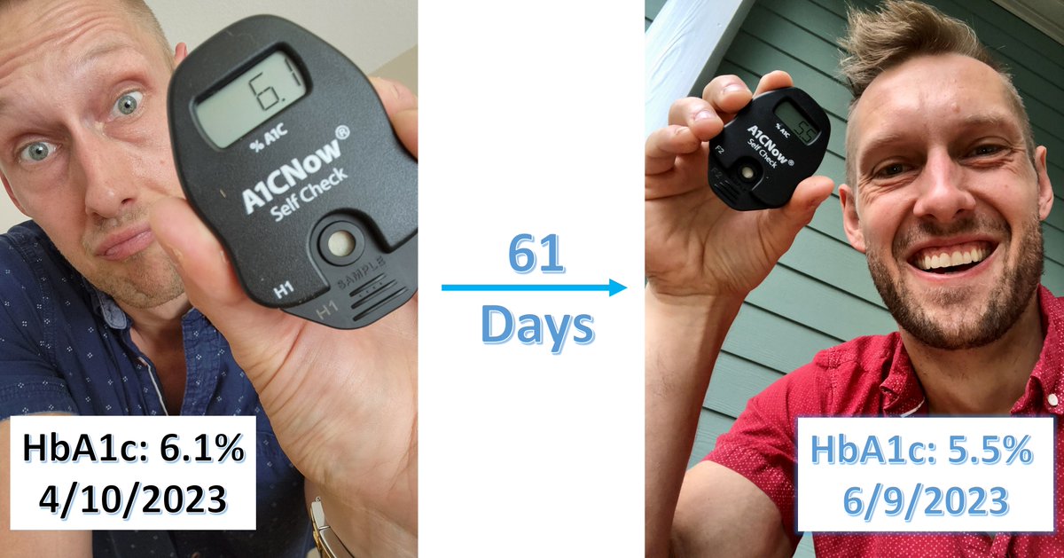 Day 61:
#type1diabetes
#JourneytoNormalGlycemia

Today's HbA1c: 5.5%💙

...normoglycemia complete...T1D journey continues...

CGM👇