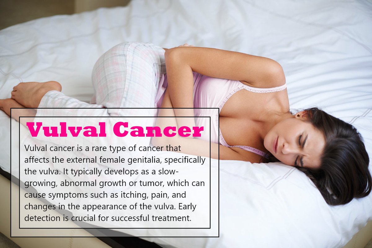 Cancer of the vulva is a rare type of cancer that affects women. The vulva is a woman's external genitals.
#vulvalcancer #TelemedicineOnline #DigitalHealthPlatform #TelehealthScreening #VirtualHealthScreening #TelemedicineSupport #VirtualHealthScreening umbrellamd.com