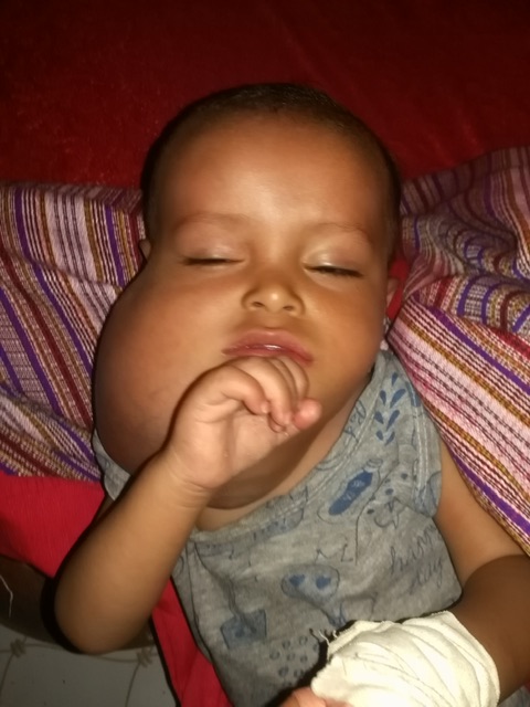 في أبين.. الطفل " أمجد " .. معاناة قاسية وآلام شديدة توجع القلب ..!!
al-omana.net/m/news201595.h…
#صحيفة_الأمناء
#الأمناء