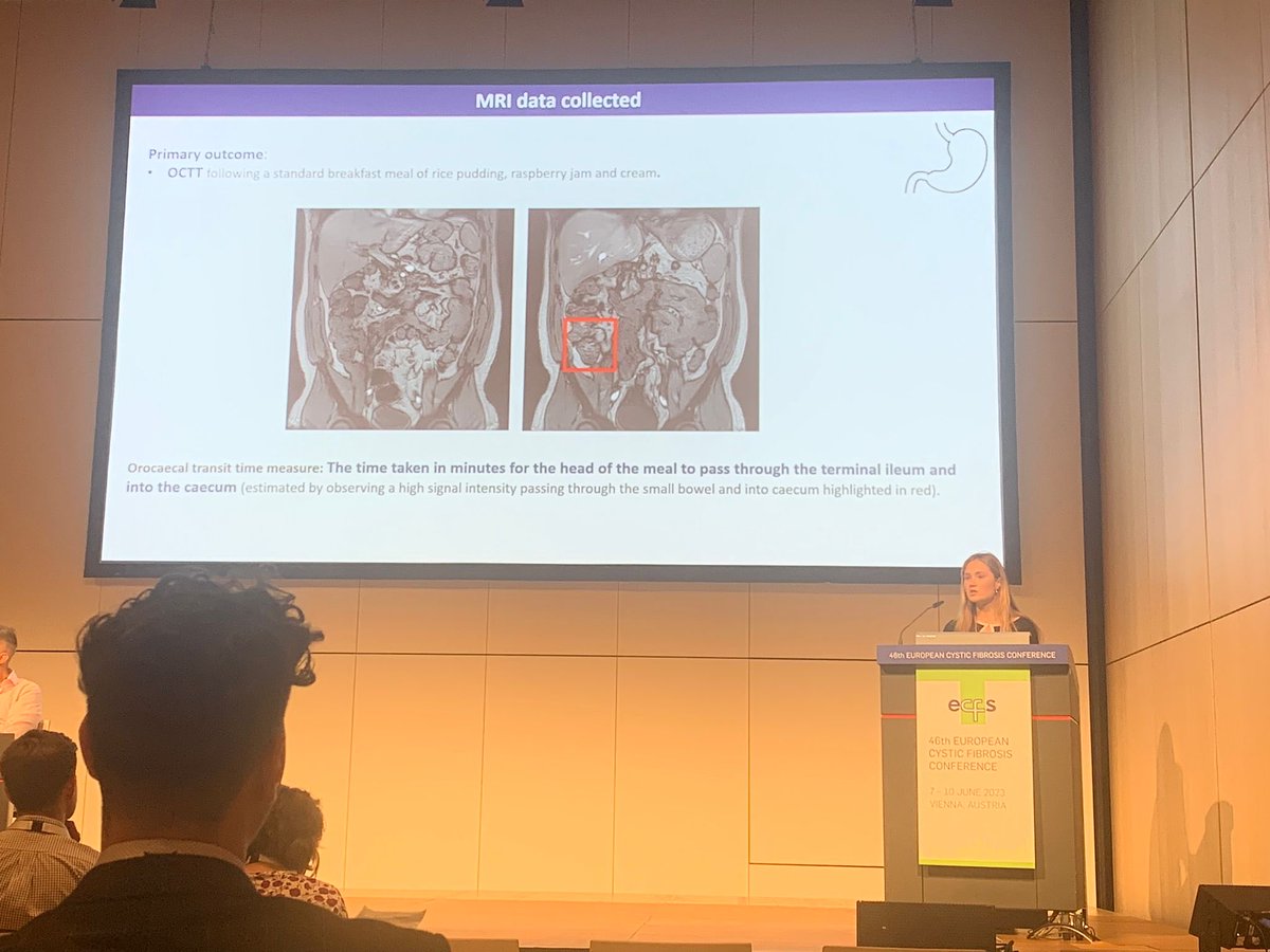 Kudos to Florence Lockwood, medical student at UoN, for a beautiful explanation of faster orocaecal transit time in cystic fibrosis during ETI treatment @ECFS2023 Part of the GIFT-CF 3 study. ⁦<a href="/ebChildHealth/">Evidence Based Child Health</a>⁩ ⁦<a href="/CFAware/">cf/Aware</a>⁩ ⁦<a href="/questionCF/">Question CF</a>⁩