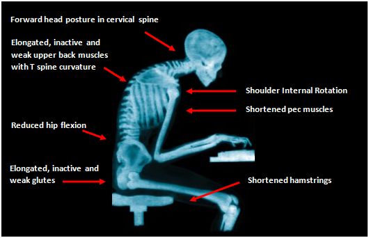 Nate_D_Stone's tweet photo. Men, sitting is the new smoking.

Sitting more than 8 hours per day increases your risk of early death by 34%!

Here are 5 exercises to help you reverse the damage of sitting 👇 https://t.co/jUj7Hh68Nf