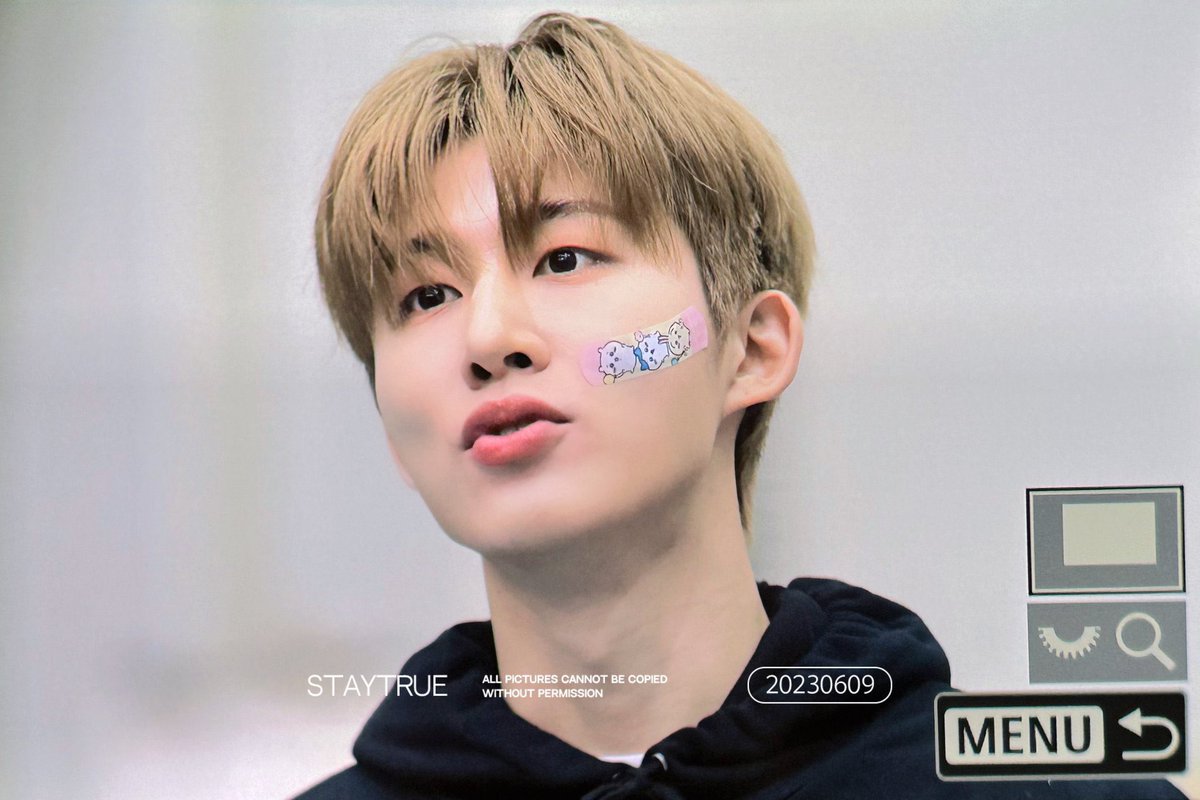 khbsource's tweet photo. the bandaids are back 🩹#HANBIN https://t.co/07Xc1ZxoUl