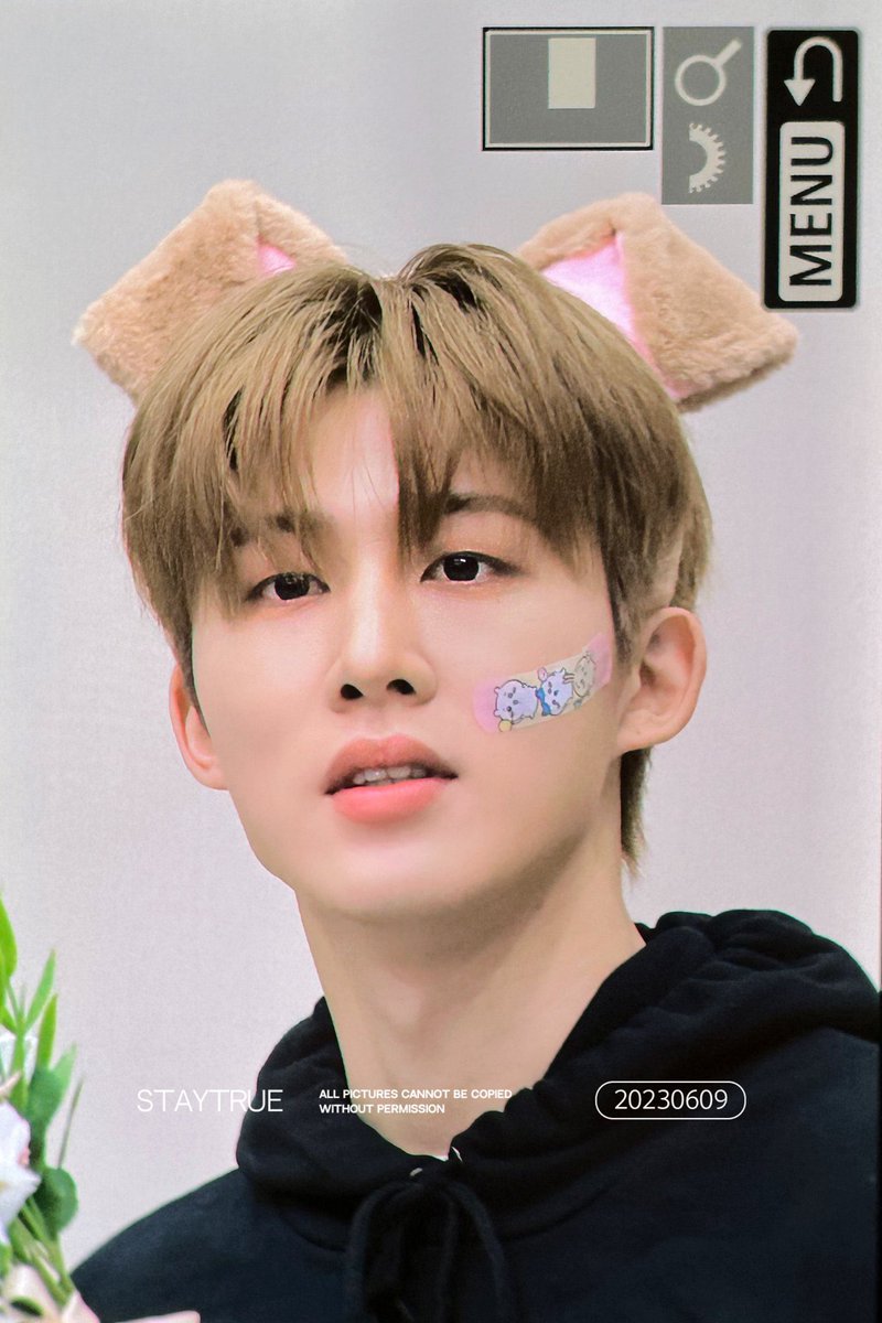 khbsource's tweet photo. the bandaids are back 🩹#HANBIN https://t.co/07Xc1ZxoUl