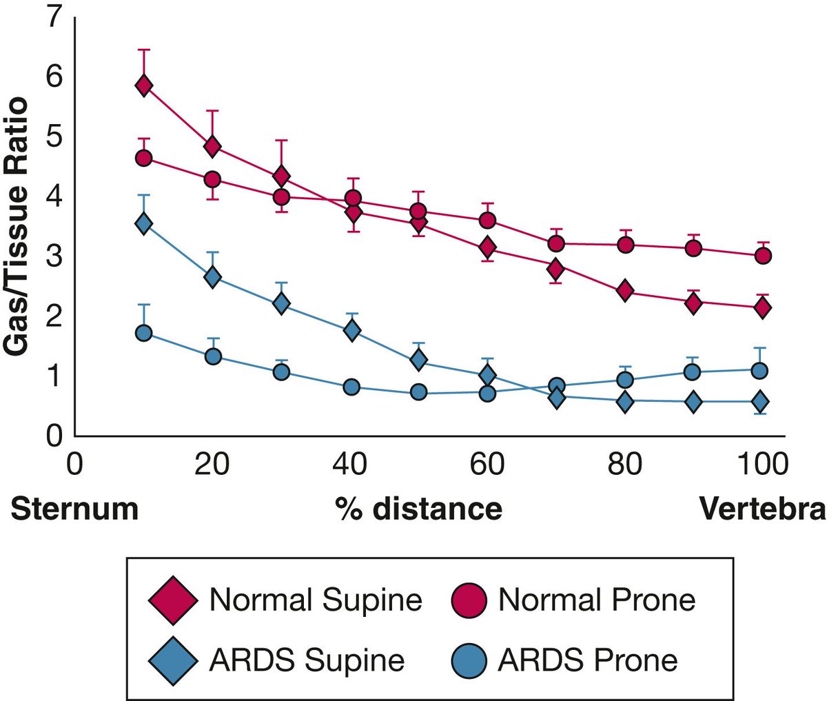 NephroPOCUS on Twitter "Graph showing the effect of the prone position