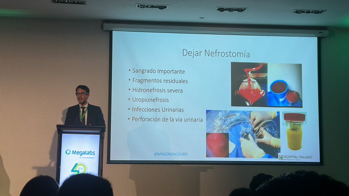 Nefrolitectomia percutanea, con o sin nefrostomía? 

<a href="/MSGONZALEZURO/">Mariano Sebastian Gonzalez</a> 
<a href="/Urotapiamingo/">Andrés</a> 

#endouro #endourologia #urologia