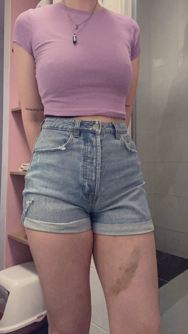 Rocking the pole bruises in this hot weather lol https://t.co/BwFMWH0hl2
