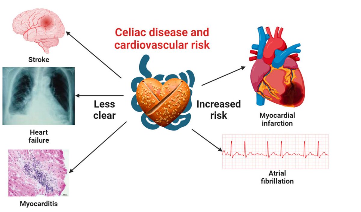 Please check out our latest review on celiac disease and the risk of cardiovascular diseases, led by <a href="/DrYichenWang/">Yichen Wang, MD MSc FACP</a> <a href="/KrittanawongMD/">Chayakrit Krittanawong, MD, FACC</a>. 

mdpi.com/1422-0067/24/1…