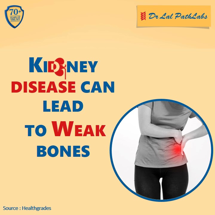 Your kidneys do more than you think! Besides removing waste products from the body, they make an active form of vitamin D (needed to absorb calcium & phosphorus) and also help regulate the mineral balance.
#FactualFriday #Kidney #KidneyDiseases #KidneyDiseaseAwareness