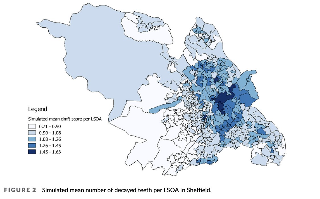 Prof Sarah Baker (@sarahrbakerdph) on Twitter photo Interestingly, we found that areas of the city paying more sugar tax (raw amount of extra tax paid) were not those with the highest tooth decay or deprivation scores 🤔
#dentistry <a href="/SipherC/">SIPHER Consortium</a> <a href="/SPHSUSystemsSci/">Systems Science in Public Health</a> <a href="/ajheppenstall/">Alison Heppenstall</a> <a href="/dannydorling/">Danny Dorling News</a> <a href="/dimitris_ballas/">Dimitris Ballas (dimitris-ballas.bsky.social)</a> <a href="/tw_broomhead/">Tom Broomhead</a> <a href="/felly500/">greg fell FFPH</a> Interestingly, we found that areas of the city paying more sugar tax (raw amount of extra tax paid) were not those with the highest tooth decay or deprivation scores 🤔
#dentistry <a href="/SipherC/">SIPHER Consortium</a> <a href="/SPHSUSystemsSci/">Systems Science in Public Health</a> <a href="/ajheppenstall/">Alison Heppenstall</a> <a href="/dannydorling/">Danny Dorling News</a> <a href="/dimitris_ballas/">Dimitris Ballas (dimitris-ballas.bsky.social)</a> <a href="/tw_broomhead/">Tom Broomhead</a> <a href="/felly500/">greg fell FFPH</a>