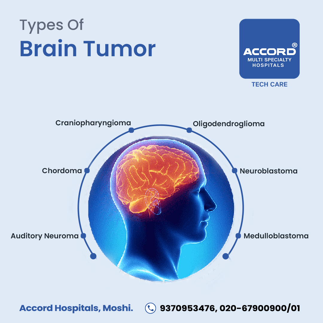 Brain tumours come in many shapes and sizes, and can affect different parts of your brain. For accurate diagnosis and treatment, visit Accord Multispeciality Hospital. 
  
🌍accordhospitals.com
📲 +91 9370953476/02067900900

#BrainTumours #braintumorawareness  #neurosurgery