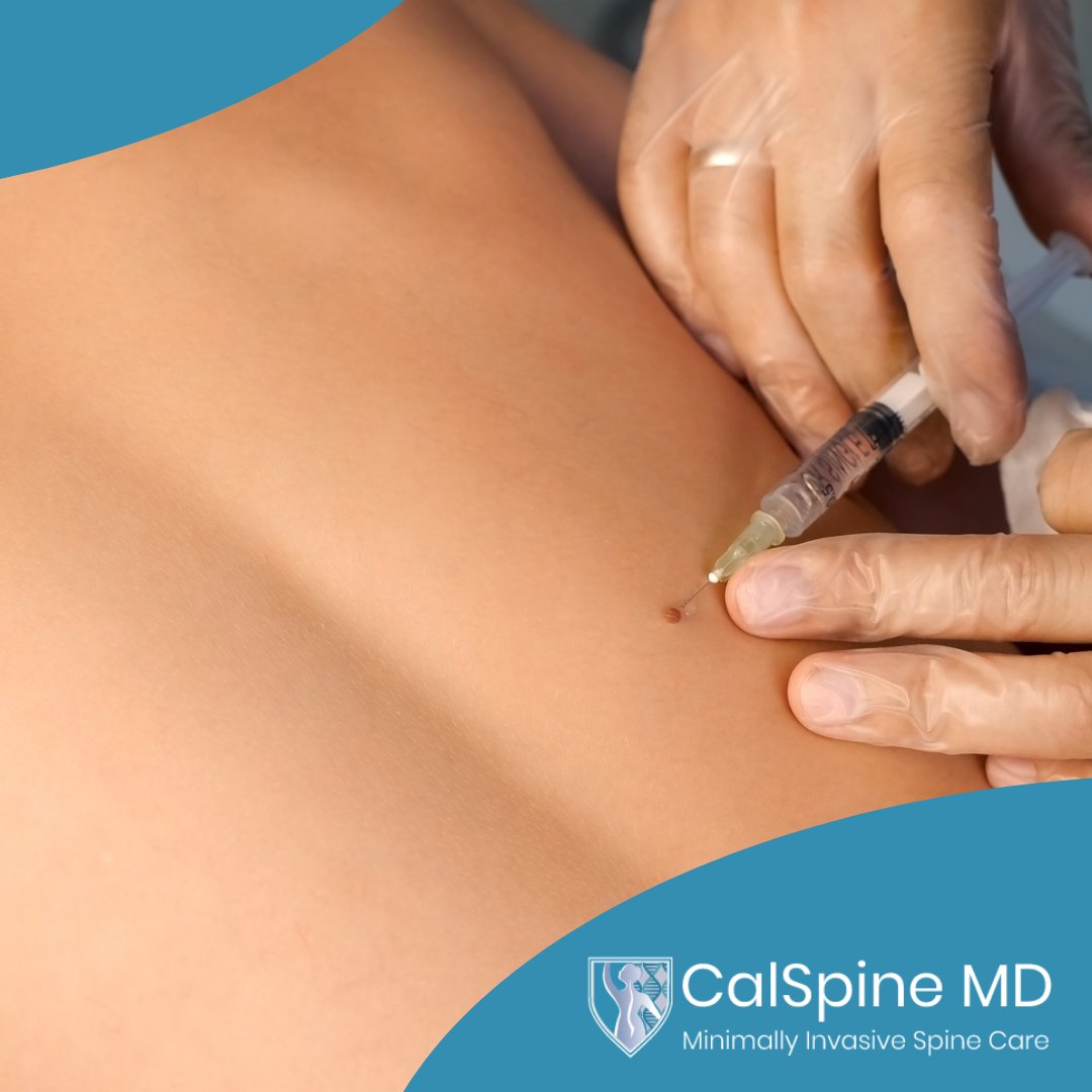CalSpineMD's tweet photo. Regenerative medicine uses natural tissue engineering, cellular therapies, and medical devices to repair tissue or organs damaged as a result of disease, trauma, or congenital issues. 

Call CalSpine MD to schedule a consultation with Dr. Ball today 📞 (925) 667-3538. https://t.co/NTYSB3Q6WT