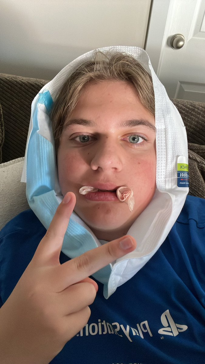 zadok_z's tweet photo. No video this week sadly, got my wisdom teeth removed https://t.co/MhsJkoU431