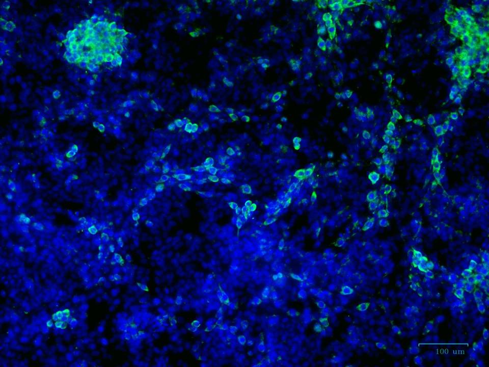 This is not a fancy image but means a lot.  It was one of the first #immunofluorescence for #ZIKV made in the lab in 2016 during the beginning of the crisis in Brazil. Happy #fluorescentfriday