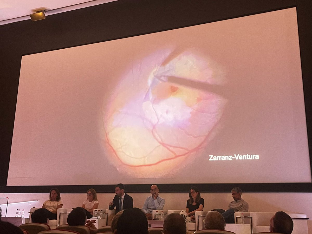 JavierZarranz's tweet photo. Controversias @hbellvitge 2023: Oncologia Ocular & Retina Quirurgica. Un placer participar en la mesa de cirugia macular! @hospitalclinic #RetinalSurgery #OpticDiscPit #MacularHole #ILMflap #AutologousRetinalTransplant #ART @idibaps @RetinaSERV @Club_Esp_Macula @OftalmologiaSEO https://t.co/qX6VxbAh0O