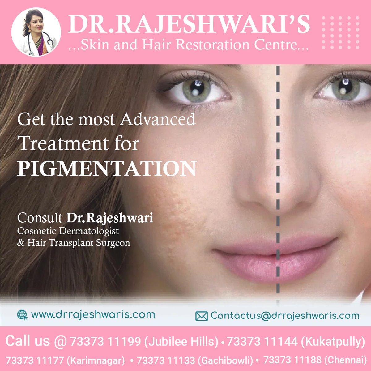 Experience the power of advanced treatments for pigmentation, specially curated to give you flawless skin. Don't let pigmentation dull your shine any longer! 

#AdvancedTreatment #ByePigmentation #FlawlessSkin #SkincareSolutions #ClearComplexion #NoMoreSpots #PigmentationRemedy