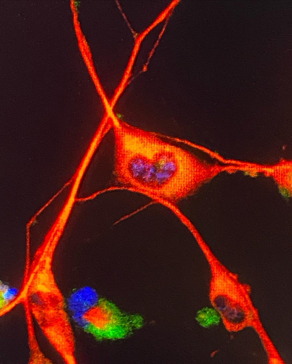 Dila_htn's tweet photo. ✨🧚🏻‍♀️🧡
~ I know my little cells, you love me too!🤗

“Whatever you do, do it with Love!” 💞

“Ne yaparsan yap, Aşk ile yap!”💓
https://t.co/8snPyWwctI

👩🏻‍🔬PhDiaries👩🏻‍💻

#DoingPhD #WomenInScience #WomenInSTEM #Neuroscience #PeripheralNerve #Biomaterial #TheUniversityofSheffield https://t.co/cESO6Qr4OQ