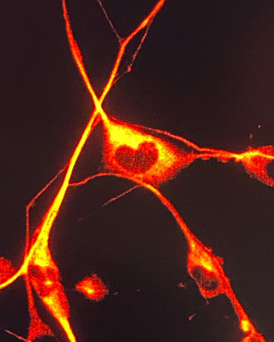 Dila_htn's tweet photo. ✨🧚🏻‍♀️🧡
~ I know my little cells, you love me too!🤗

“Whatever you do, do it with Love!” 💞

“Ne yaparsan yap, Aşk ile yap!”💓
https://t.co/8snPyWwctI

👩🏻‍🔬PhDiaries👩🏻‍💻

#DoingPhD #WomenInScience #WomenInSTEM #Neuroscience #PeripheralNerve #Biomaterial #TheUniversityofSheffield https://t.co/cESO6Qr4OQ