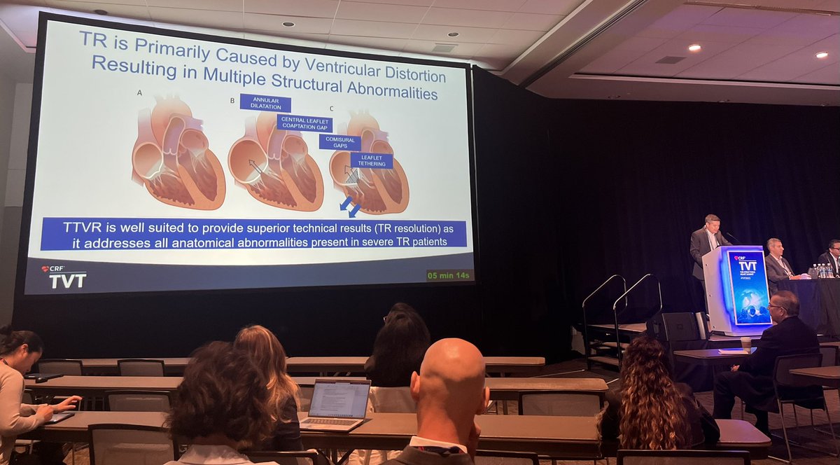 crfheart's tweet image. Are #TMVR devices designed to meet #tricuspid needs? Dr. Juan Granada examines the technological challenges and opportunities for #innovation in #TTVR. #TVT2023 #CardioEd #CardioResearch