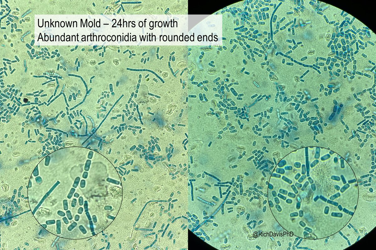 #MicroRounds (Day 960): 'Panic! At the Arthro'

Scenario: You're a new tech in Mycology. A fuzzy mold grows from sputum @ 24hrs & you see the following microscopically: fields packed w/ chains of arthroconidia!

Do you call it Coccidioides??! (stay tuned) #ASMClinMicro #IDTwitter