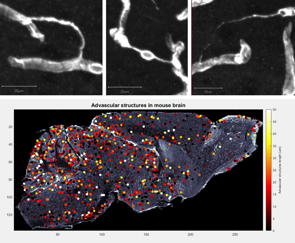 Dr. Audrey Chagnot (@audreychagnot) on Twitter photo Are they collapsed capillaries, bridging cells or tunelling nanotubes? In <a href="/MontagneLab/">Montagne Lab</a> we explore these strange advascular structures with innovative tools! Join us at @UU_University for CVB 2023 and discover more on my poster! Are they collapsed capillaries, bridging cells or tunelling nanotubes? In <a href="/MontagneLab/">Montagne Lab</a> we explore these strange advascular structures with innovative tools! Join us at @UU_University for CVB 2023 and discover more on my poster!