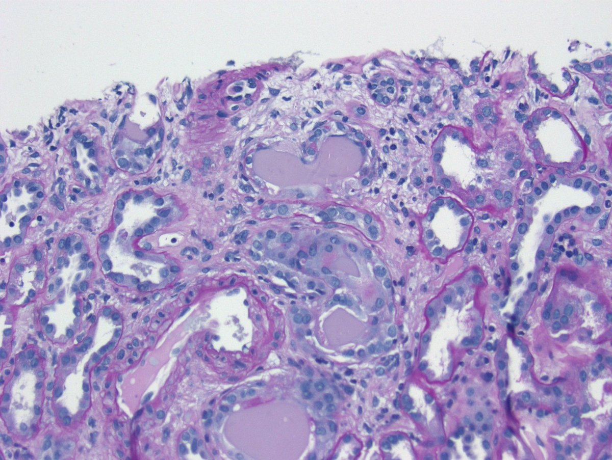 Kuang-Yu Jen, MD, PhD tweet media