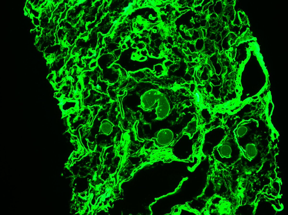 Kuang-Yu Jen, MD, PhD tweet media