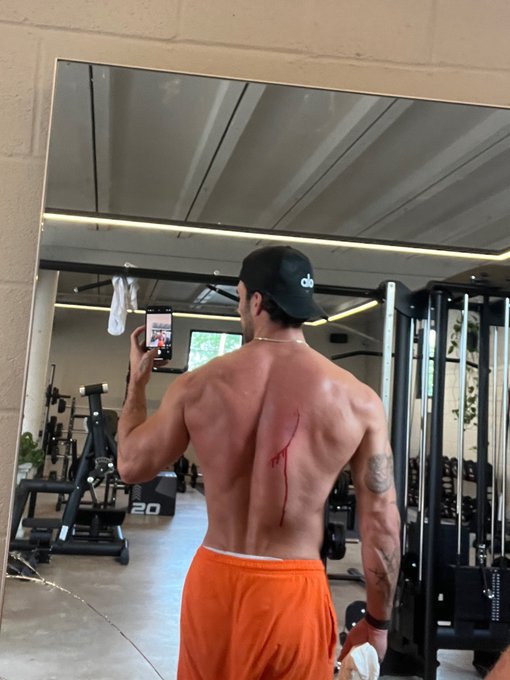 🤕 https://t.co/67GkGxIn4w