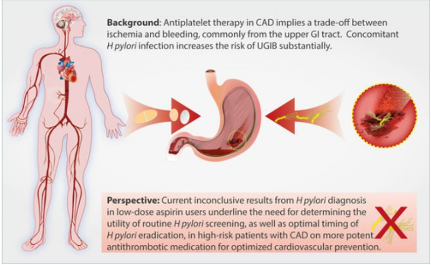 Circulation (@circaha) on Twitter photo #Perspective Is it time for routine H.pylori screening in patients with coronary artery disease? <a href="/Robodoc2013/">Robin Hofmann</a> <a href="/karolinskainst/">Karolinska Institutet</a> <a href="/TransCardio/">Translational Cardiology</a> <a href="/ProfMagnusBack/">Magnus Bäck</a> #AHAJournals ahajournals.org/doi/10.1161/CI… #Perspective Is it time for routine H.pylori screening in patients with coronary artery disease? <a href="/Robodoc2013/">Robin Hofmann</a> <a href="/karolinskainst/">Karolinska Institutet</a> <a href="/TransCardio/">Translational Cardiology</a> <a href="/ProfMagnusBack/">Magnus Bäck</a> #AHAJournals ahajournals.org/doi/10.1161/CI…
