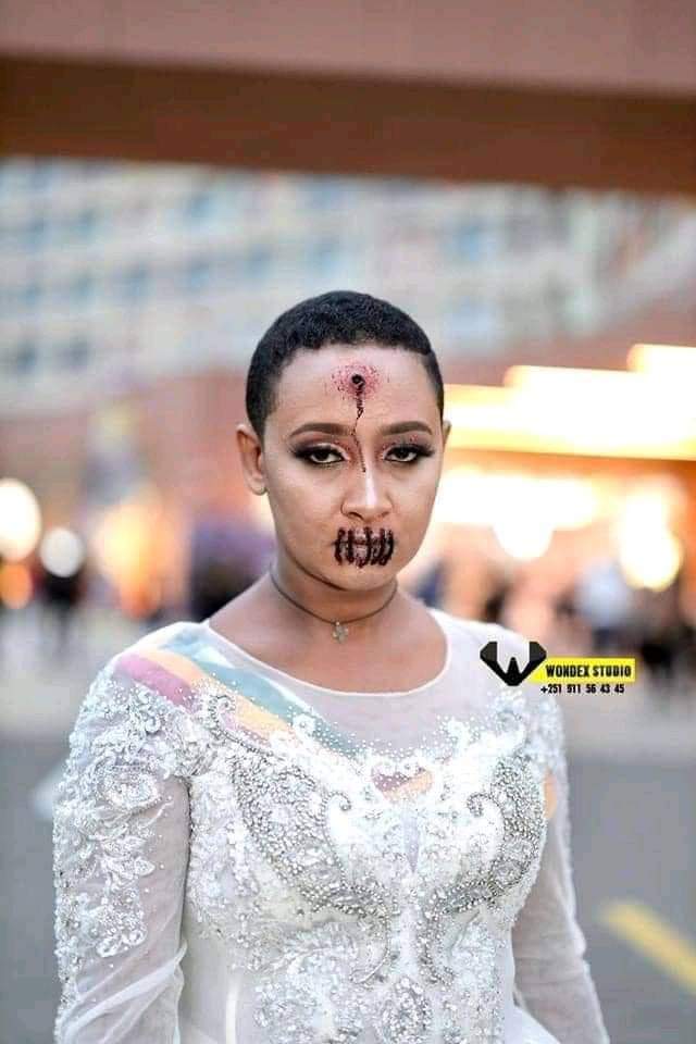 #Speakup for those who #cannotspeak for themselves, for the rights of all who are destitute. Speak up and judge fairly; defend the rights of the poor!