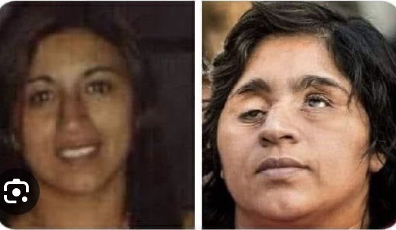 pia_sin_filtro's tweet photo. Esta es la realidad, Fabiola Campillay antes y después. Esto es lo que la Diputada Cordero no quiere ver. Sus comentarios representan el negacionismo que se incrustó en nuestro país. No podemos permitirnos tener más parlamentarios que nieguen las violaciones a los DDHH en 🇨🇱 https://t.co/htGxIuzlET