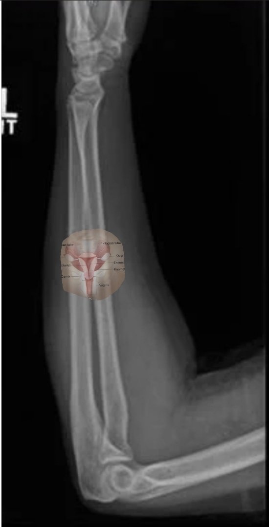 Results of Lance McCullers Jr MRI results have been leaked

The findings are pictured below