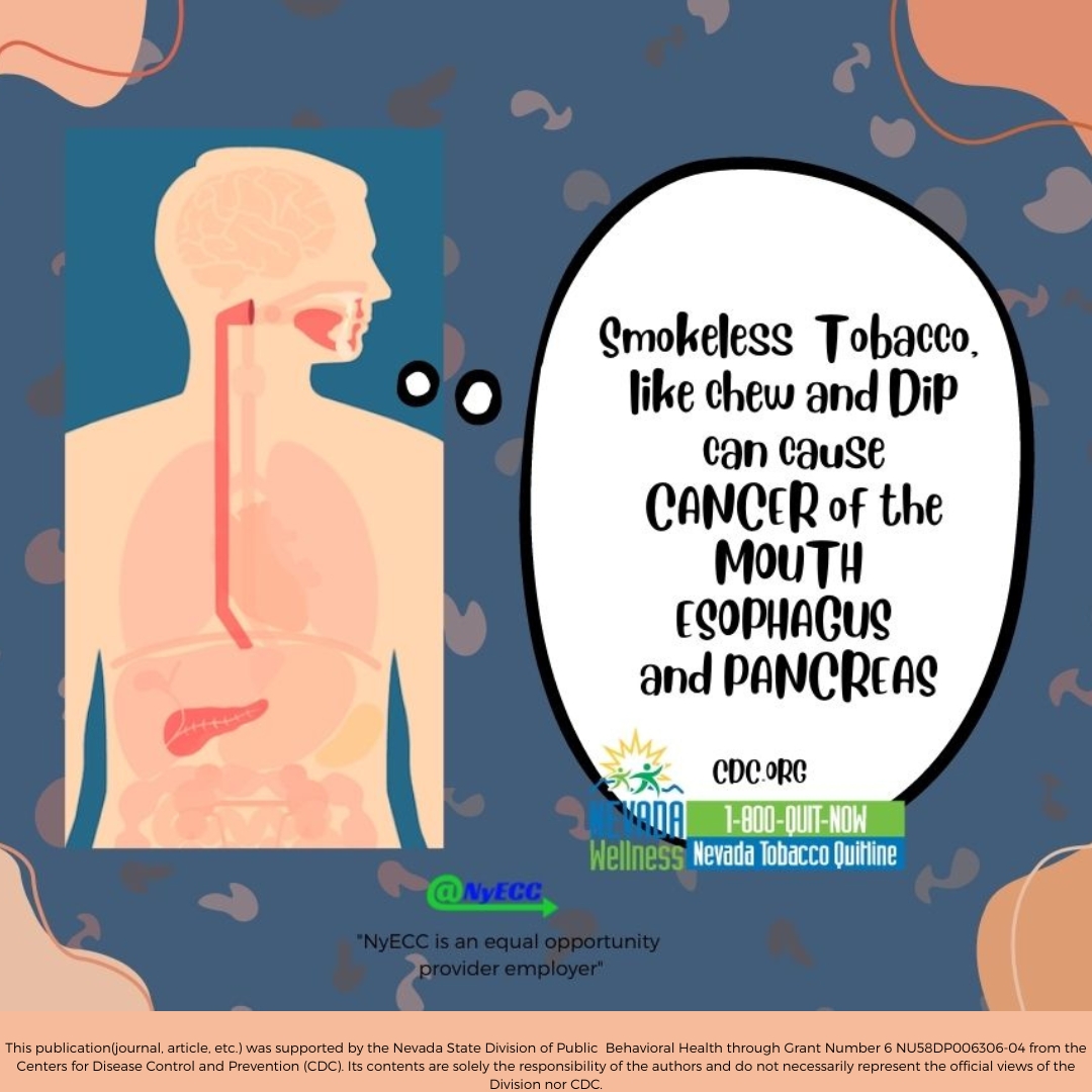Smokeless tobacco, like chew and dip can cause cancer of the mouth esophagus and pancreas. #notobacco #QuitNow