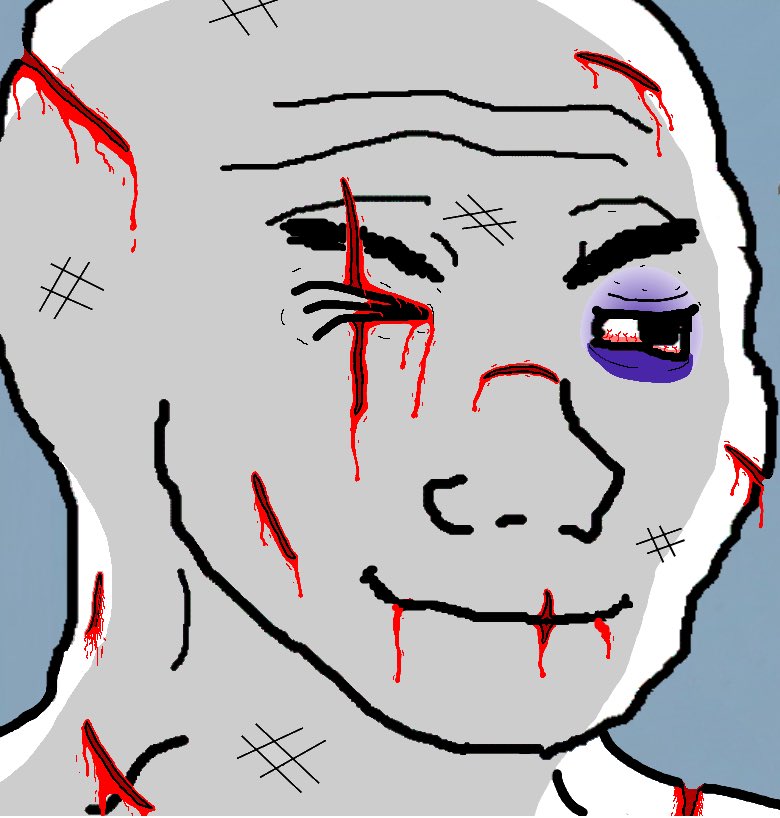 *coughs and spits up blood, bodily functions noticeably deteriorating*

that the best you could do?