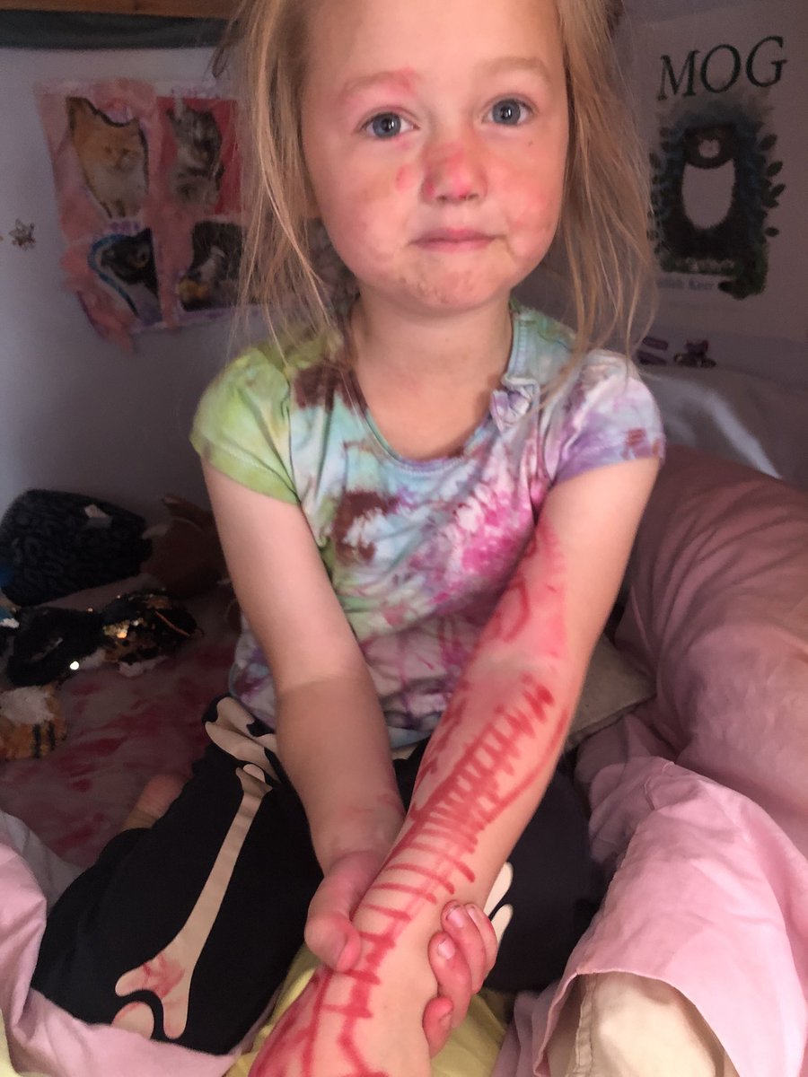 Any tips for getting sharpie off my child? She decided to give herself some tattoos in the middle of the night……#help #parentingfail