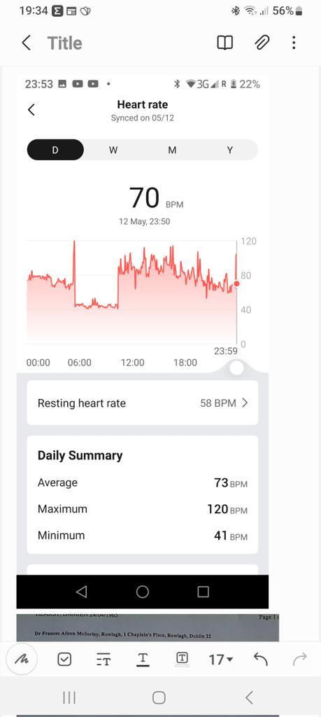 @P_McCulloughMD @espn @FOXSports @JonnyRoot_ I have LC for two years which arrived at the same time as the Pfizer shot. There have been nights where I was convinced I would not see the dawn. This is my heart trace from one such night recently.  Low 40s for hours, I was awake but unable to move during that time.