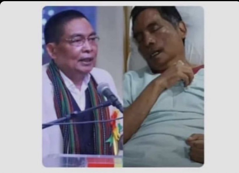 Zoukim27's tweet photo. Beating up someone to a point where you can no longer recognise his face anymore. On that fateful day,Sir Vungzagin Valte MLA,was on his way back home after meeting the CM when he encountered a mob. Very fishy right??His vehicle was stopped and he was dragged out along with his driver and security. They released the security only because he was a meitei. But our MLA and the driver were tied,blindfolded and thrashed by the radical meiteis with the intention of killing them. Timely action by thề security guard and intervention by the police only saved our MLA but his driver had passed away then. In a place where not even MLAs or top officers are safe,who can assure of our safety? 

We want peace in the form of separation administration. 
#ManipurViolence
#SeparateAdministration 
 
Learn more about his condition here:https://t.co/M9vHpvl6eM
