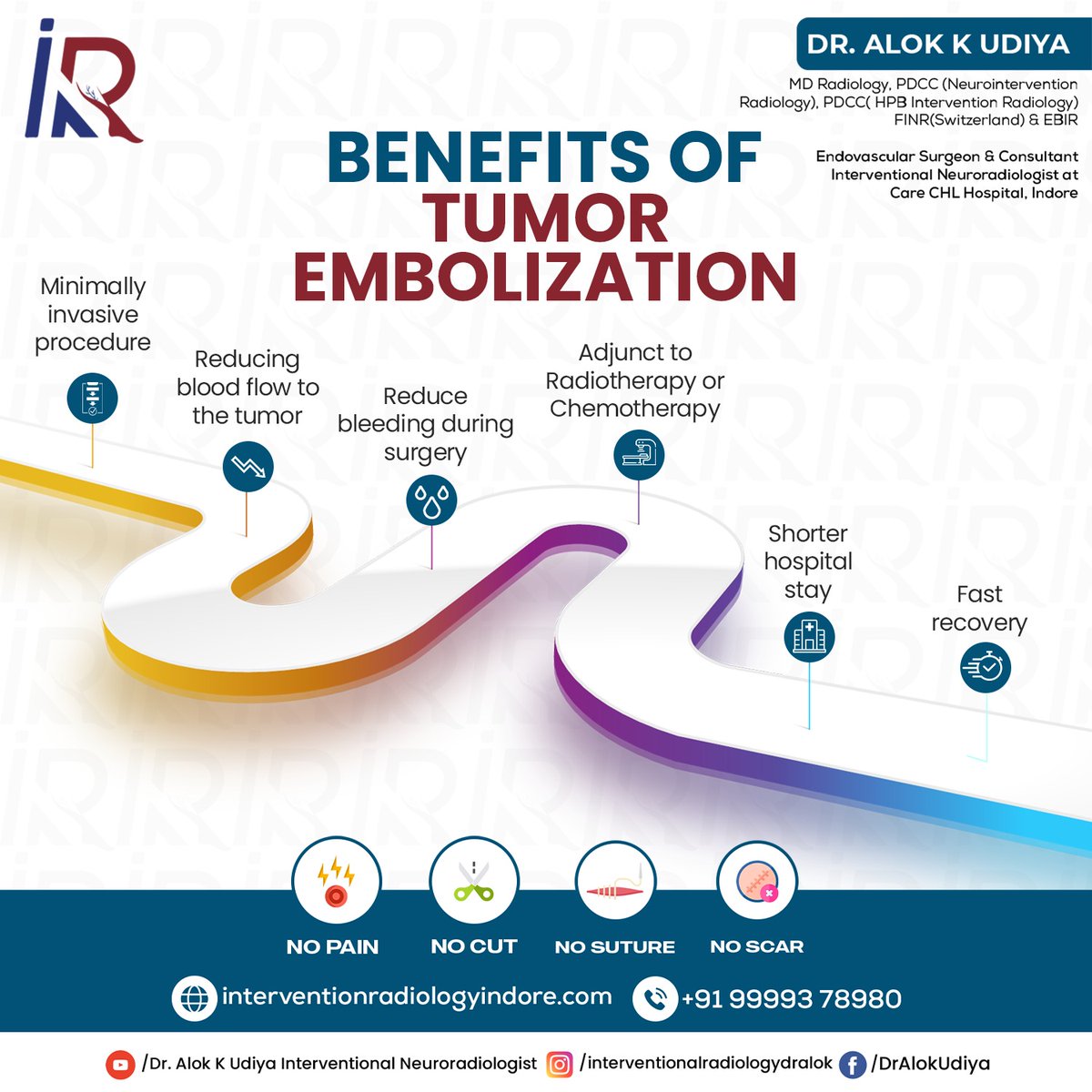 For more information about tumor embolization,
Consult Dr. Alok K Udiya +91 99993 78980

#braintumor #tumorembolization #meningioma #minimallyinvasive #brain #stroketreatment  #brainhealth #brainacare #interventionalradiologist #IR #interventionalneuroradiologist