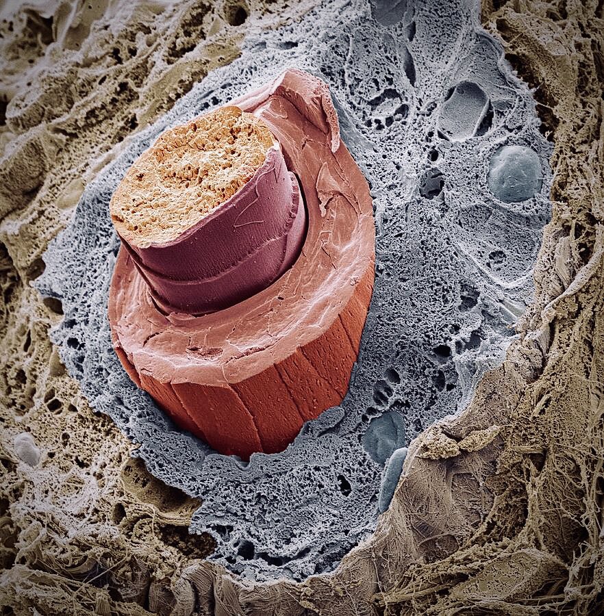 broken eyelash under the electron microscope